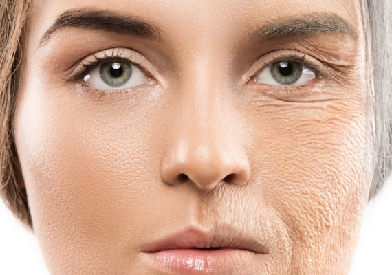 ANTI AGING