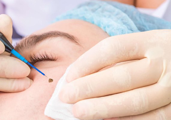 DERMATO SURGERY